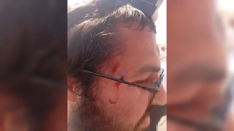 Image from Arutz Sheva